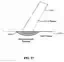 Fig. 19 - Systems and methods for nanowire growth and harvesting