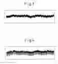 Fig. 03 - Preoriented yarn package