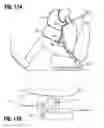 Fig. 15 - Passenger protective device and method