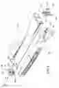 Fig. 03 - Face panel anchoring apparatus