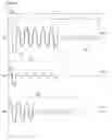 Fig. 01 - Gas discharge lamp dimming control method
