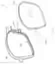 Fig. 17 - Spectacles set with decorative frame