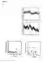 Fig. 07 - Confocal microscope system for real-time simultaneous temporal measurements of metachronal wave period and ciliary beat frequency
