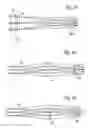 Fig. 14 - Providing optical systems having improved properties to users of catalog (stock) lenses