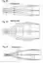 Fig. 25 - Providing optical systems having improved properties to users of catalog (stock) lenses