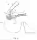 Fig. 05 - Body cavity illumination system