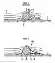 Fig. 02 - Seabed seismic cables and methods of stabilizing same when deployed on a seabed