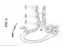 Fig. 07 - Hearing aid eartip