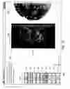 Fig. 09 - Controlling thick-slice viewing of breast ultrasound data