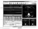 Fig. 06 - Methods and software for self-gating a set of images