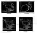 Fig. 09 - Methods and software for self-gating a set of images