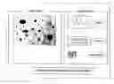 Fig. 05 - Segmentation and data mining for gel electrophoresis images