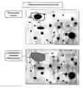 Fig. 07 - Segmentation and data mining for gel electrophoresis images