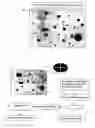 Fig. 08 - Segmentation and data mining for gel electrophoresis images
