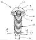 Fig. 01 - Bonding fastener