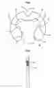 Fig. 03 - Retaining ring for shaft