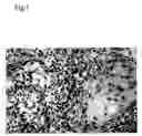 Fig. 02 - Method for modulating HLA class II tumor cell surface expression with a cytokine mixture