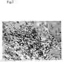Fig. 03 - Method for modulating HLA class II tumor cell surface expression with a cytokine mixture