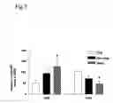Fig. 04 - Method for modulating HLA class II tumor cell surface expression with a cytokine mixture
