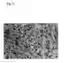 Fig. 12 - Method for modulating HLA class II tumor cell surface expression with a cytokine mixture
