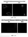 Fig. 16 - Human binding molecule against CD1a