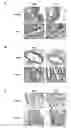Fig. 15 - Sensitizing cells for apoptosis by selectively blocking cytokines
