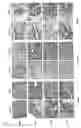 Fig. 16 - Sensitizing cells for apoptosis by selectively blocking cytokines