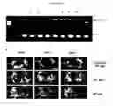 Fig. 45 - Nanoemulsion vaccines