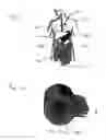 Fig. 03 - Devices for augmentation of lumen walls