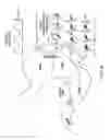 Fig. 05 - Devices for augmentation of lumen walls