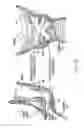 Fig. 06 - Devices for augmentation of lumen walls