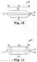 Fig. 08 - Sustained release implants and methods for subretinal delivery of bioactive agents to treat or prevent retinal disease