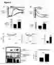 Fig. 04 - TRPC6 involved in glomerulonephritis