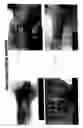 Fig. 03 - Composition and method for the therapeutic modulation of matrix metalloproteinase
