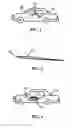 Fig. 02 - Method and apparatus for surface coating repair and rust prevention