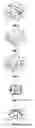 Fig. 03 - Reduced friction bracket for orthodontics