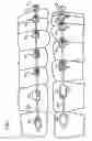 Fig. 02 - Orthodontic bracket system