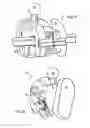 Fig. 09 - Orthodontic bracket system