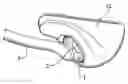 Fig. 01 - Improvements to an auxiliary element for the segmental distalization to the canine-to-molar posterior maxillary area in orthodontic treatments