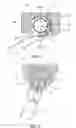 Fig. 02 - Improvements to an auxiliary element for the segmental distalization to the canine-to-molar posterior maxillary area in orthodontic treatments