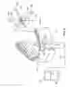 Fig. 06 - Methods for correcting tooth movements midcourse in treatment