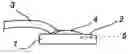Fig. 01 - Arrangement for dental imaging