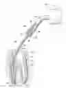 Fig. 01 - Endodontic procedure employing simultaneous liquefaction and acoustic debridgement