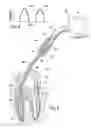 Fig. 02 - Endodontic procedure employing simultaneous liquefaction and acoustic debridgement