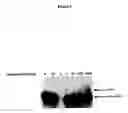 Fig. 06 - Methods for identifying small molecules that modulate premature translation termination and nonsense mediated mRNA decay