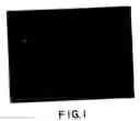 Fig. 02 - Detection of chromosomal abnormalities associated with breast cancer