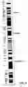 Fig. 10 - Detection of chromosomal abnormalities associated with breast cancer