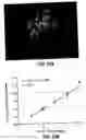 Fig. 11 - Detection of chromosomal abnormalities associated with breast cancer