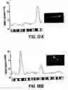 Fig. 13 - Detection of chromosomal abnormalities associated with breast cancer