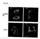 Fig. 25 - Method for isolating intracellular antibodies able to neutralize protein interactions